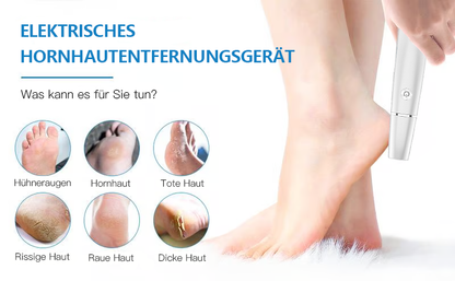 💥Elektrischer Hornhautentferner für die Füße👣