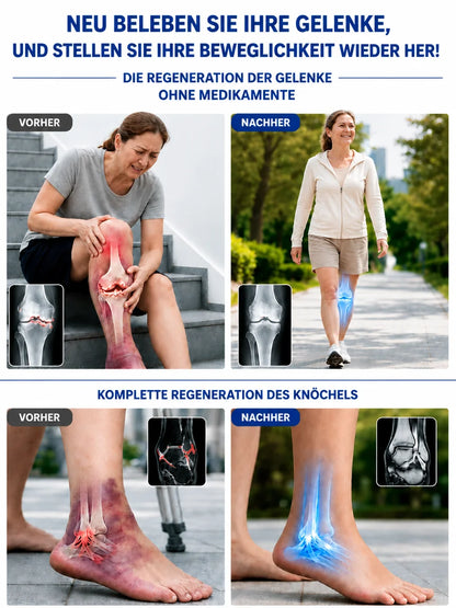 🦴💪Glucosamin-Knorpelreparaturgel nach US-Militärstandard