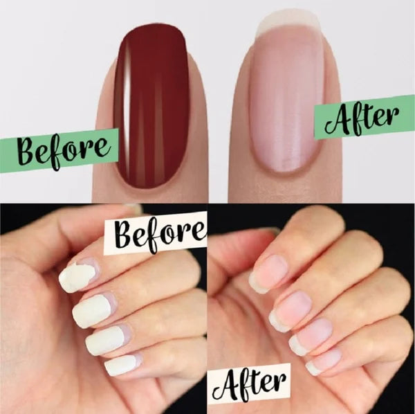 🥳HEISSER SALE 2026🥳💞50.000+ VERKAUFT!👵❤️ Verbesserter Magic Nagellackentferner🎨💅