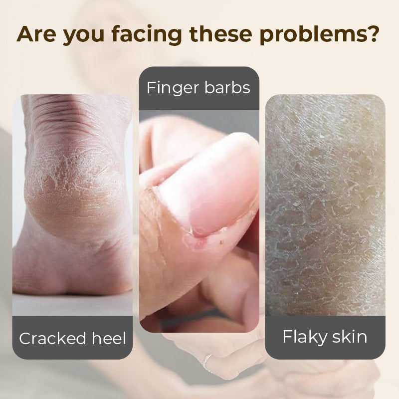 🔥 HEISSER VERKAUF 🔥 Feuchtigkeitsspendende & Anti-Riss-Fußcreme – Intensive Feuchtigkeit, Repariert trockene & rissige Fersen, Weicht raue Haut auf ✨