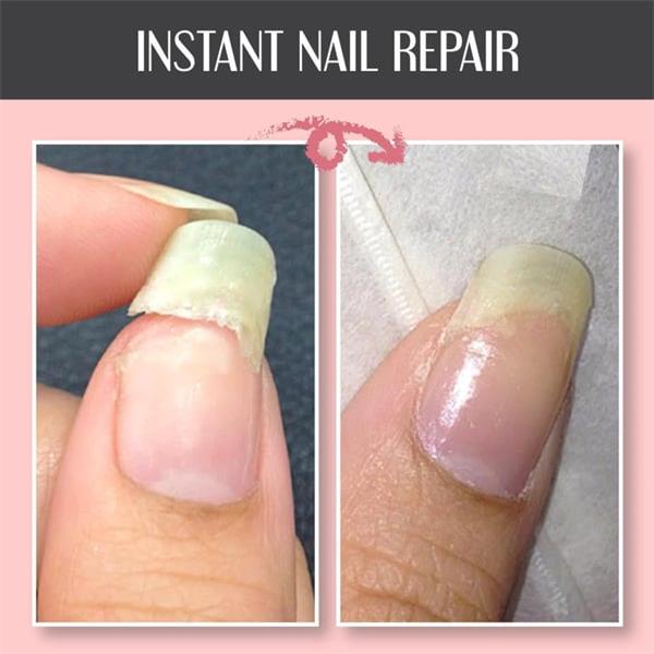 🌟2025 Schutzgel für Nagelreparatur💅 kaufen 2 Holen Sie sich 1 kostenlos