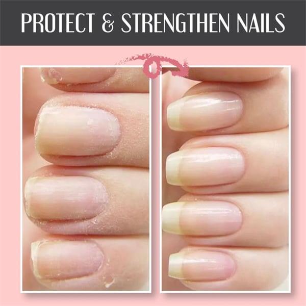 🌟2025 Schutzgel für Nagelreparatur💅 kaufen 2 Holen Sie sich 1 kostenlos