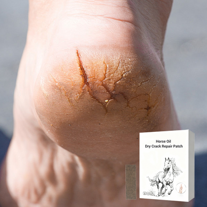 Pferdeöl Dry Crack Repair Patch für Hände und Füße