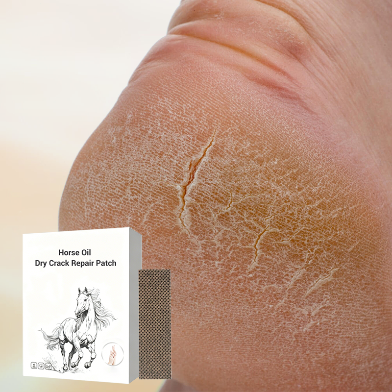 Pferdeöl Dry Crack Repair Patch für Hände und Füße
