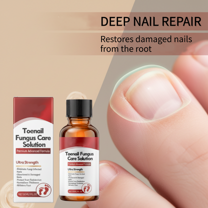 Nägel Reparatur Essenz für beschädigte Nägel
