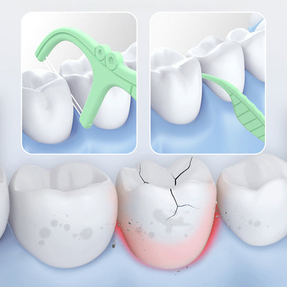 Fresh Floss Set with Convenient Storage Case