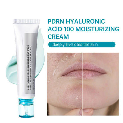 🥳HEISSER SALE 2026🥳💞50.000+ VERKAUFT!👵❤️ 50 % RABATT!  PDRN Hyaluronsäure 100 Feuchtigkeitscreme