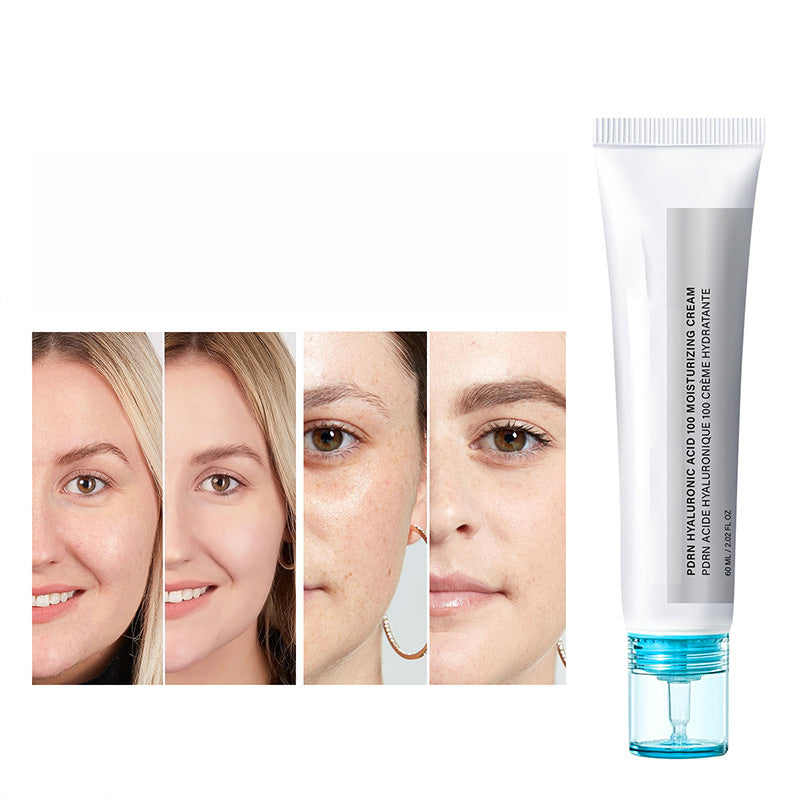 🥳HEISSER SALE 2026🥳💞50.000+ VERKAUFT!👵❤️ 50 % RABATT!  PDRN Hyaluronsäure 100 Feuchtigkeitscreme