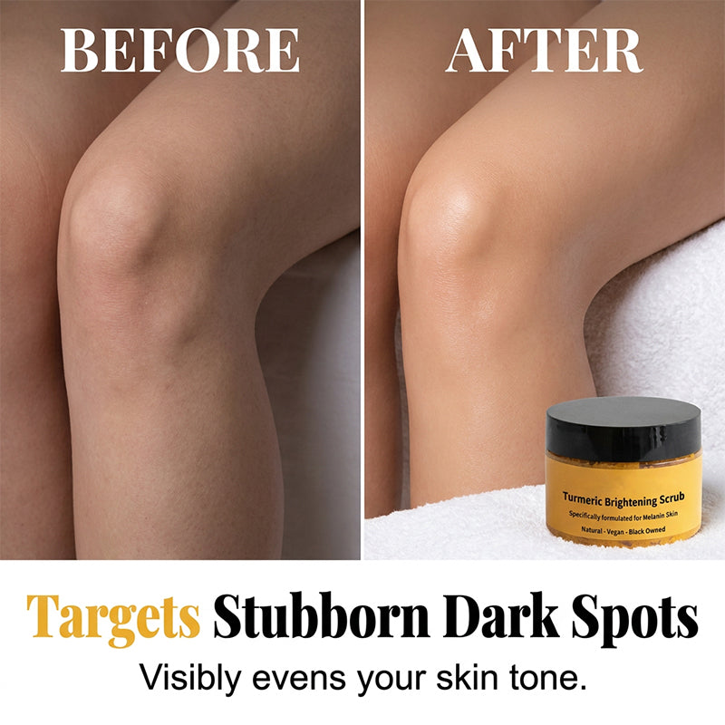 🥳 HEISSER SALE 2026 – 50% RABATT! 💞 70.000+ VERKAUFT ! Turmeric Exfoliating Body Scrub