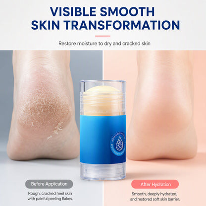 🔥FLASH SALE🔥 Feuchtigkeitsspendender Vaseline-Gel-Stick – Squalan & Hyaluronsäure, Anwendung ohne Hände – Für trockene Hände, Füße & Fersen – Pfirsich oder Orange  🧴✨
