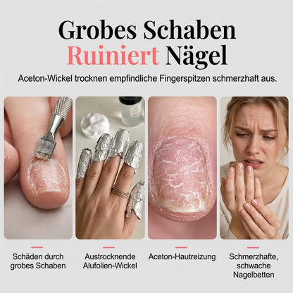 🔥50% RABATT! 💅 36W Dampf-Nagellackentferner – professionelles Gerät für Gellack & Acrylnägel, für Maniküre & Zuhause